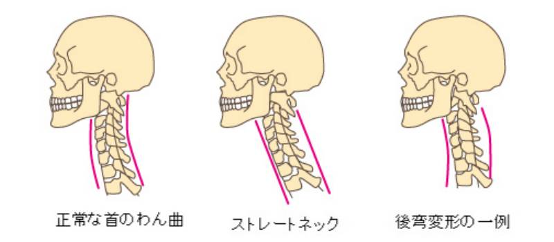 まくらの選び方 首回り＆寝る姿勢に合わせたまくらを選ぼう ...